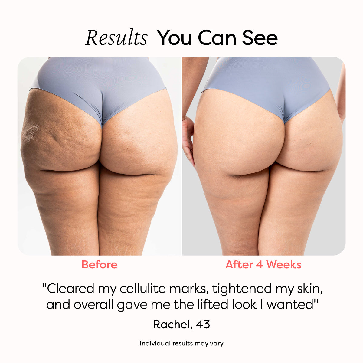 Celuluxe Scuplter™